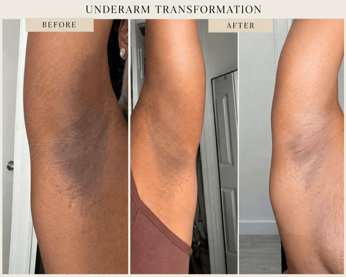 GOLDEN GLOW CLEANSER | DARK SPOT CORRECTOR - The Butterfly Effect
